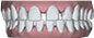 widely spaced teeth